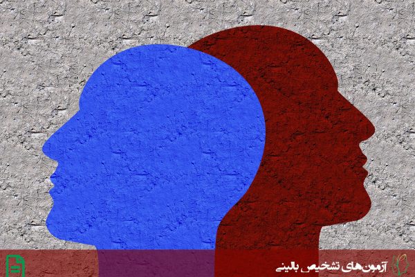 آزمون 90 – SCL