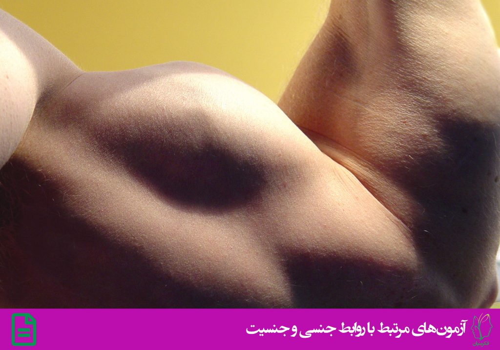 مقیاس طرح واره ی جنسی مردان