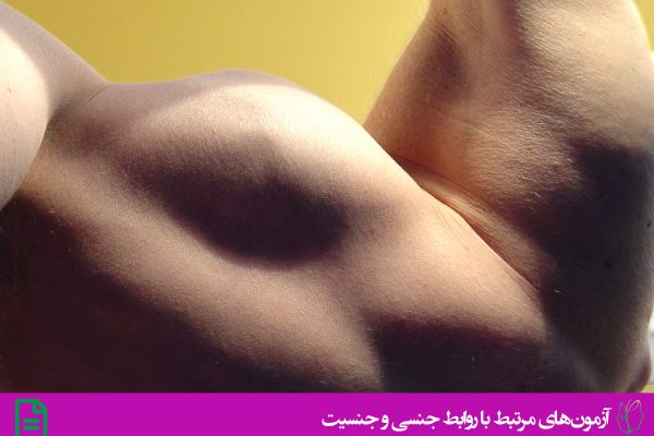 مقیاس طرح واره ی جنسی مردان