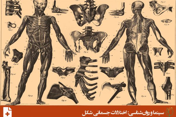 اختلال نشانه جسمانی