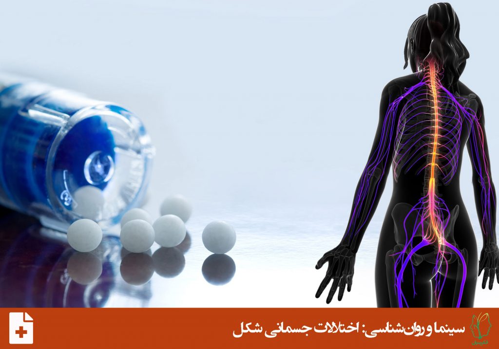 اختلال تبدیلی یا اختلال نشانه ی کارکرد عصبی