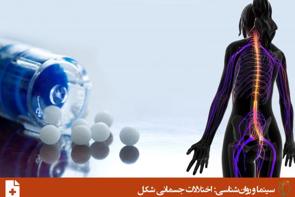 اختلال تبدیلی یا اختلال نشانه ی کارکرد عصبی