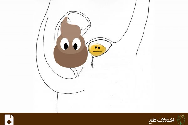 بی اختیاری دفع