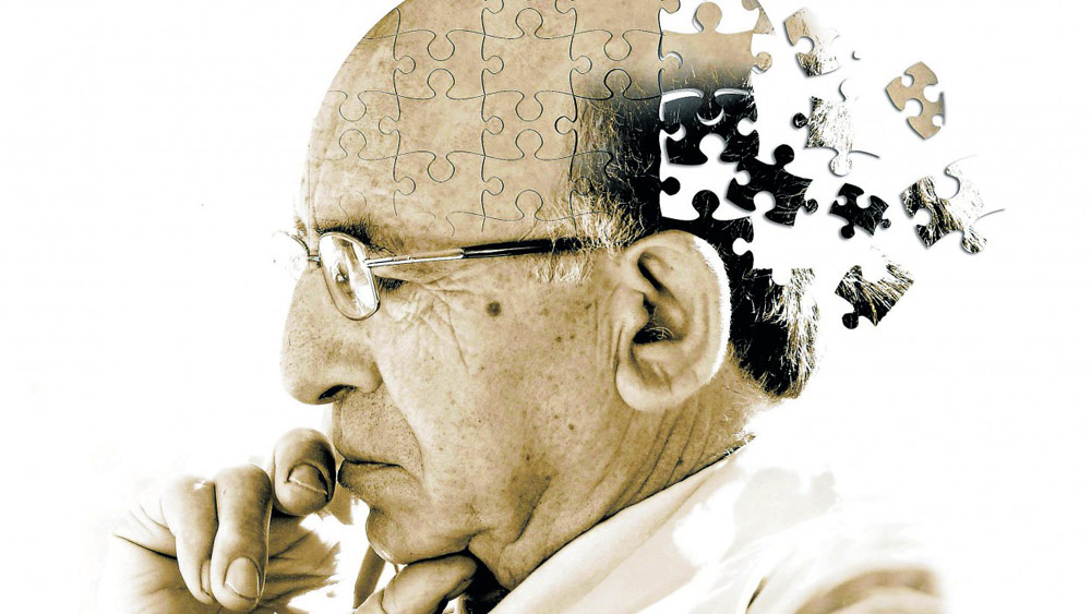 آلزایمر (Alzheimer)